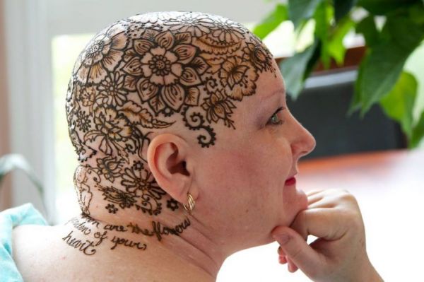 Henna koronák a rákos betegeknek